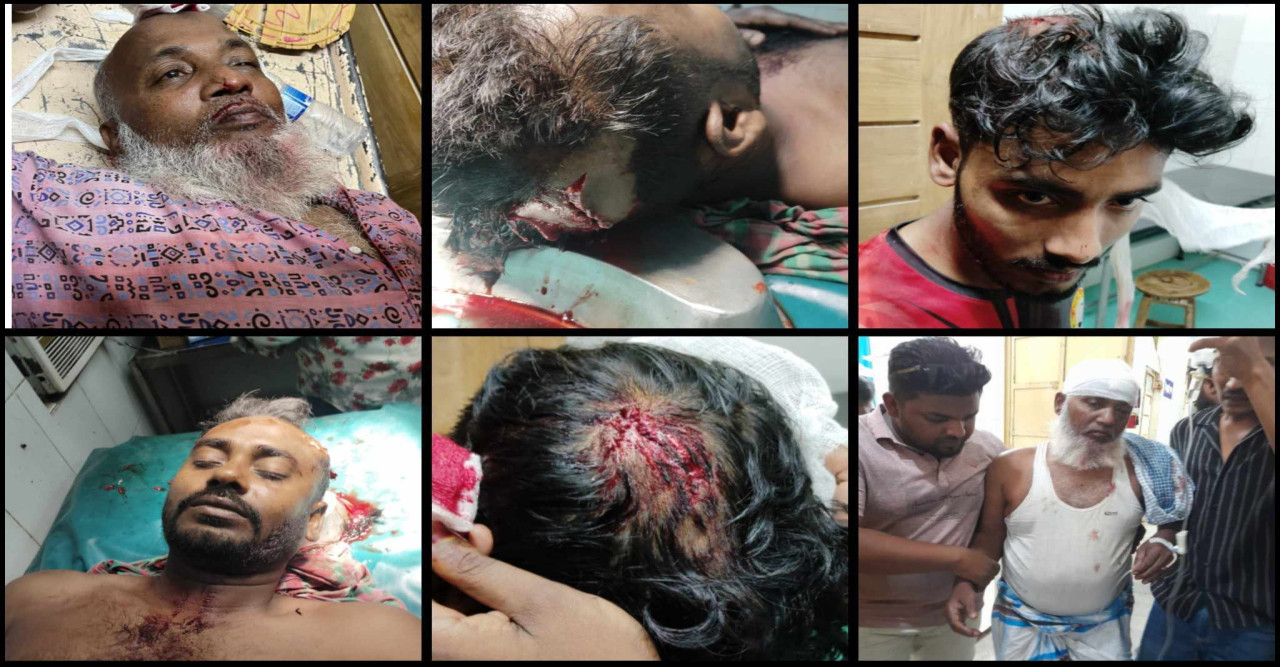 রাজশাহীতে পুকুর জবর দখল ও চাঁদা নিতে আ-লীগ সন্ত্রাসী বাহিনীর হামলা : আহত ৫